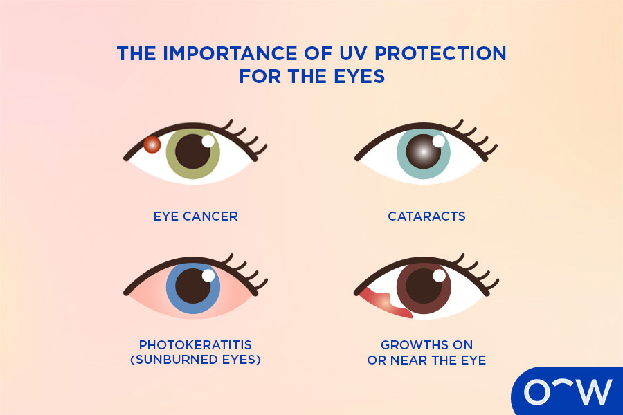 Infographic of different eye conditions that can develop from prolonged exposure to the sun’s UV.