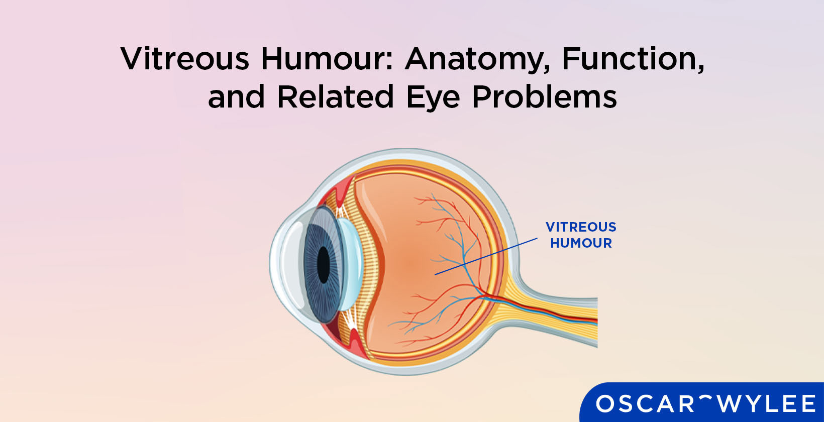 Vitreous Humour