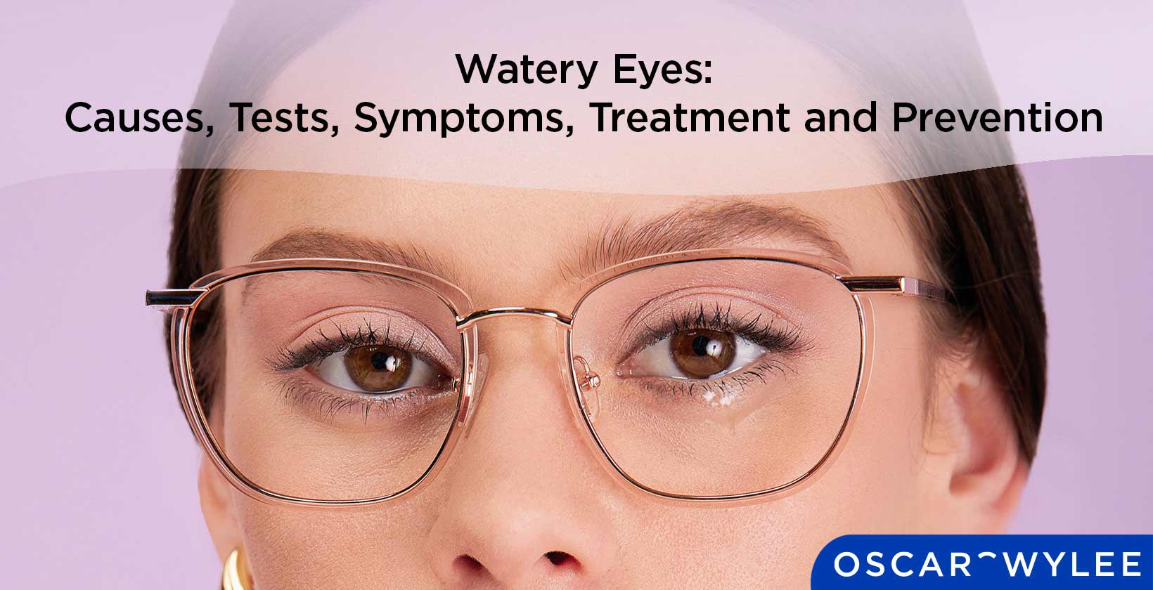 Watery Eyes