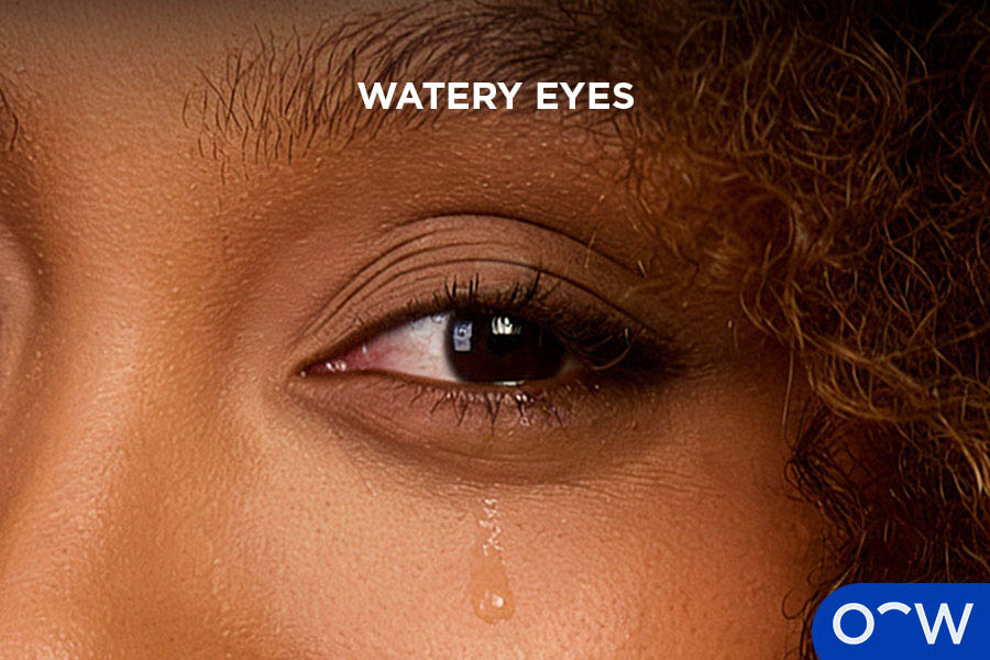 A photo of watery eyes.