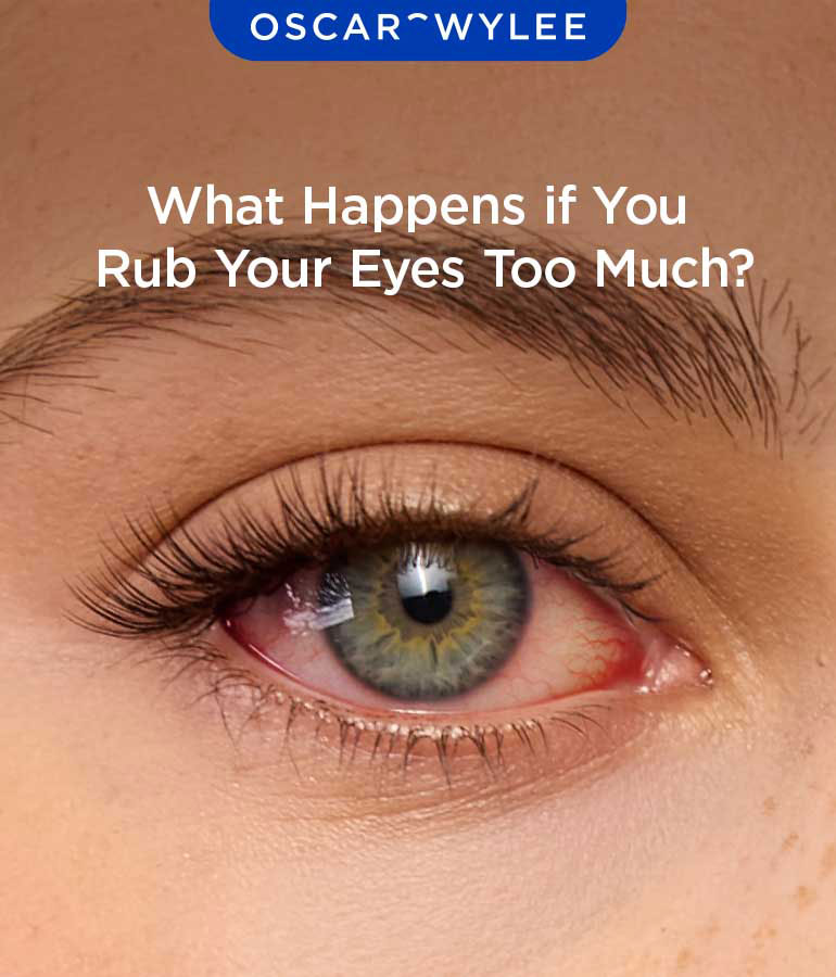 What Happens if You Rub Your Eyes Too Much?