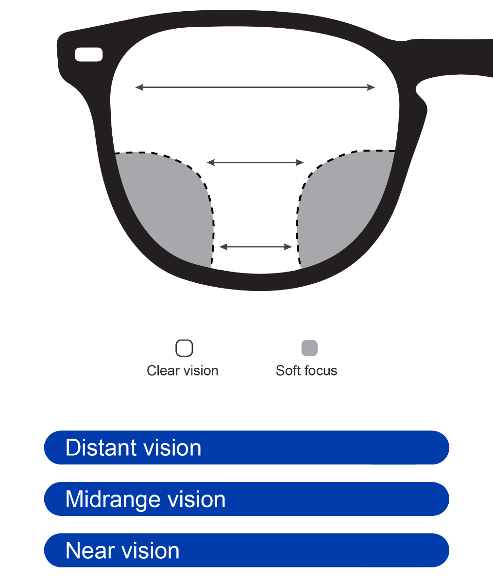 Elite multifocal
